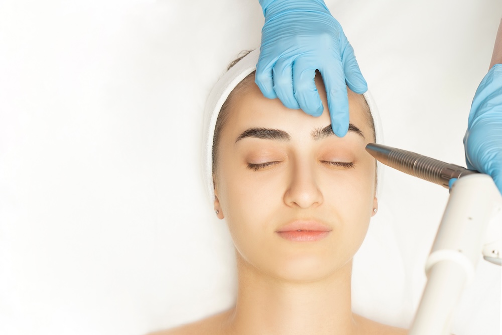 Fotona 4D Laser Facelift