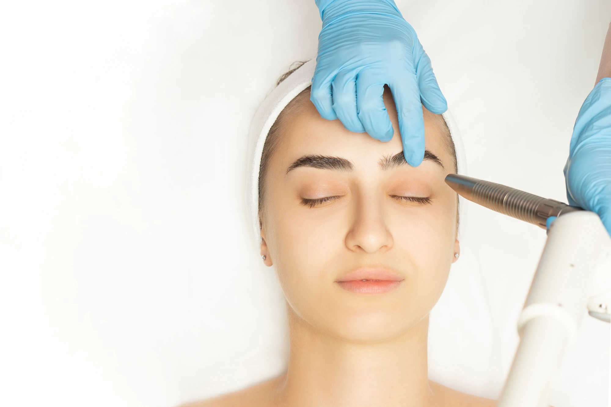 Laser Brow Lift